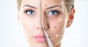 Tìm chỗ nào hút cồi mụn không nhân HCM